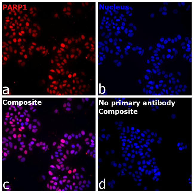 PARP1 Antibody in Immunocytochemistry (ICC/IF)
