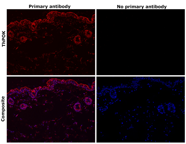 ThPOK Antibody in Immunohistochemistry (Paraffin) (IHC (P))