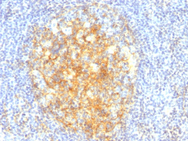 CD106/VCAM1 Antibody in Immunohistochemistry (Paraffin) (IHC (P))