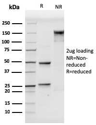 CD106/VCAM1 (Activated Endothelial Cell Marker) Antibody in SDS-PAGE (SDS-PAGE)