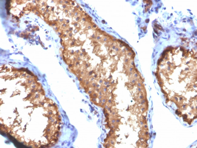 Vinculin Antibody in Immunohistochemistry (Paraffin) (IHC (P))