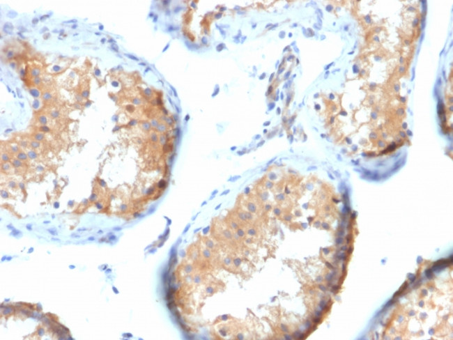 Vinculin (Marker of Age-related Macular Degeneration) Antibody in Immunohistochemistry (Paraffin) (IHC (P))