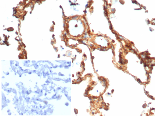 Vinculin (Marker of Age-related Macular Degeneration) Antibody in Immunohistochemistry (Paraffin) (IHC (P))