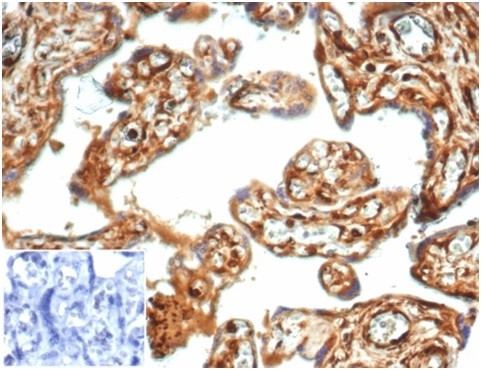 Vinculin (Marker of Age-related Macular Degeneration) Antibody in Immunohistochemistry (Paraffin) (IHC (P))