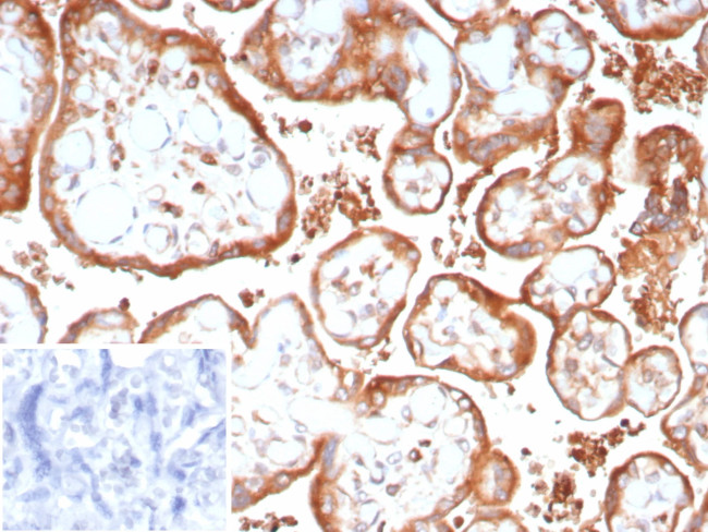 VEGF-A (Vascular Endothelial Growth Factor) Antibody in Immunohistochemistry (Paraffin) (IHC (P))