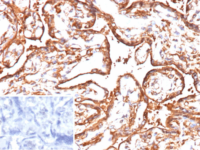 VEGF-A (Vascular Endothelial Growth Factor) Antibody in Immunohistochemistry (Paraffin) (IHC (P))