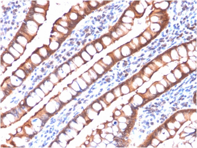 Villin (GI-Mucosal and Urogenital Brush Border Marker) Antibody in Immunohistochemistry (Paraffin) (IHC (P))