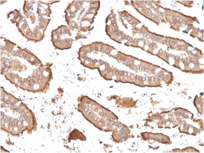 Villin (GI-Mucosal and Urogenital Brush Border Marker) Antibody in Immunohistochemistry (Paraffin) (IHC (P))