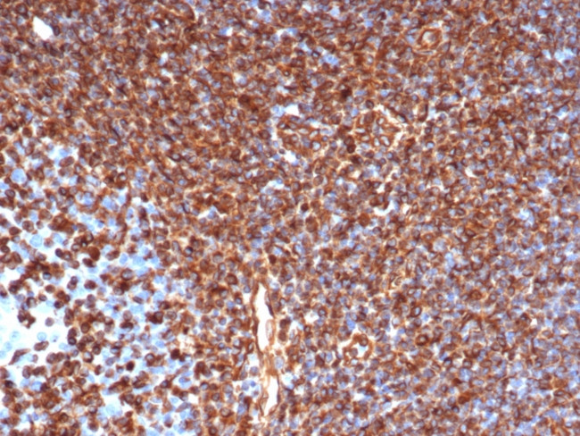 Vimentin (Mesenchymal Cell Marker) Antibody in Immunohistochemistry (Paraffin) (IHC (P))