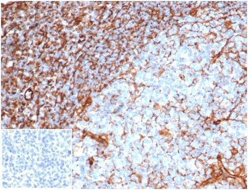 Vimentin (Mesenchymal Cell Marker) Antibody in Immunohistochemistry (Paraffin) (IHC (P))