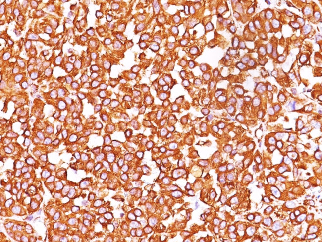 Vimentin (Mesenchymal Cell Marker) Antibody in Immunohistochemistry (Paraffin) (IHC (P))