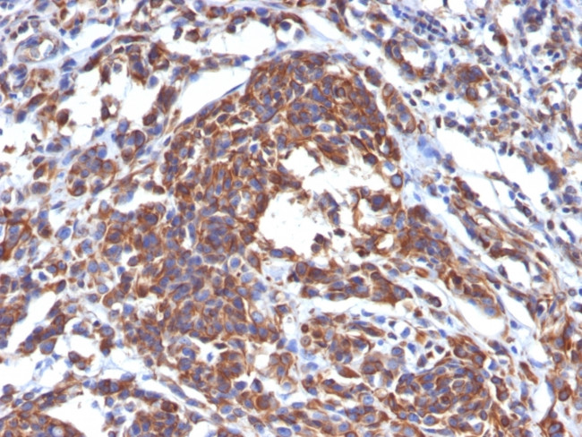 Vimentin (Mesenchymal Cell Marker) Antibody in Immunohistochemistry (Paraffin) (IHC (P))