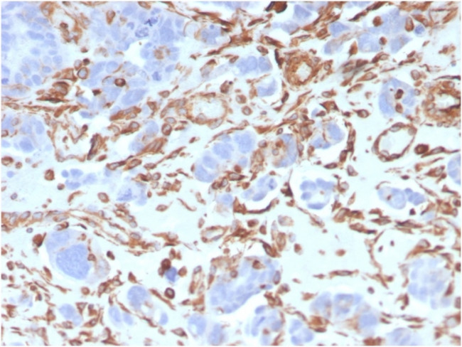 Vimentin Antibody in Immunohistochemistry (Paraffin) (IHC (P))