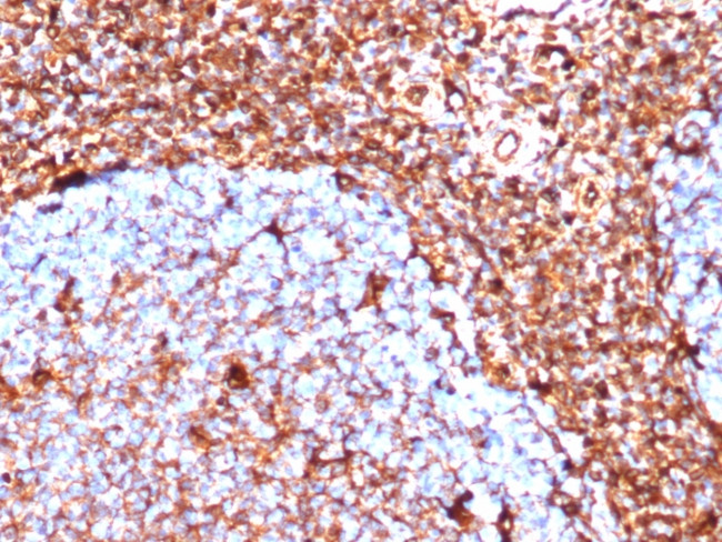 Vimentin Antibody in Immunohistochemistry (Paraffin) (IHC (P))