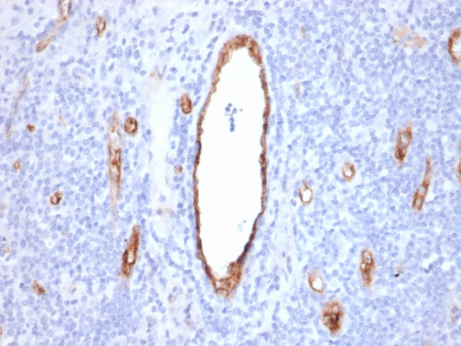 von Willebrand Factor/Factor VIII Related-Ag (Endothelial Marker) Antibody in Immunohistochemistry (Paraffin) (IHC (P))