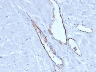 von Willebrand Factor/Factor VIII Related-Ag (Endothelial Marker) Antibody in Immunohistochemistry (Paraffin) (IHC (P))