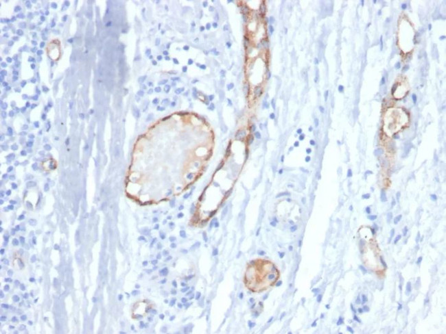 von Willebrand Factor/Factor VIII Related-Ag (Endothelial Marker) Antibody in Immunohistochemistry (Paraffin) (IHC (P))