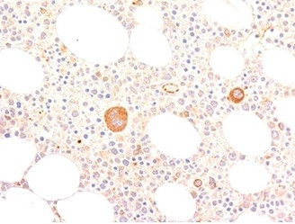 von Willebrand Factor/Factor VIII Related-Ag (Endothelial Marker) Antibody in Immunohistochemistry (Paraffin) (IHC (P))