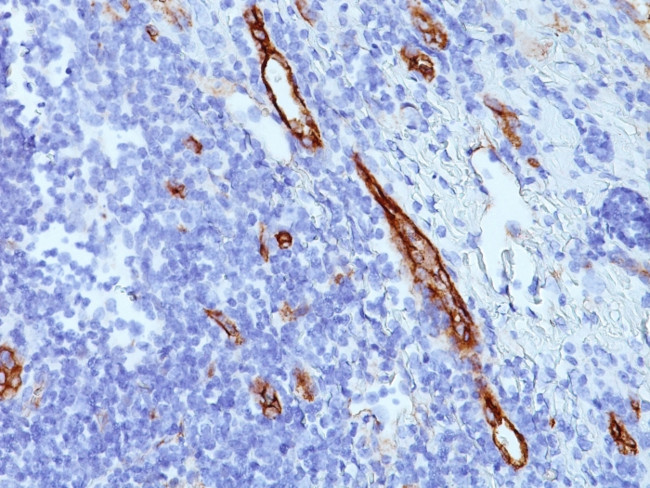 von Willebrand Factor/Factor VIII Related-Ag (Endothelial Marker) Antibody in Immunohistochemistry (Paraffin) (IHC (P))
