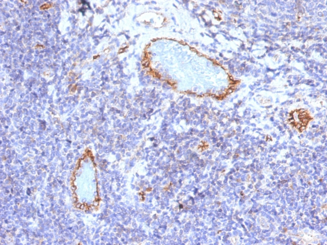 von Willebrand Factor/Factor VIII Related-Ag Antibody in Immunohistochemistry (Paraffin) (IHC (P))