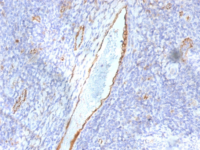 von Willebrand Factor/Factor VIII Related-Ag (Endothelial Marker) Antibody in Immunohistochemistry (Paraffin) (IHC (P))