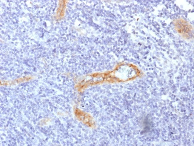 von Willebrand Factor/Factor VIII Related-Ag (Endothelial Marker) Antibody in Immunohistochemistry (Paraffin) (IHC (P))