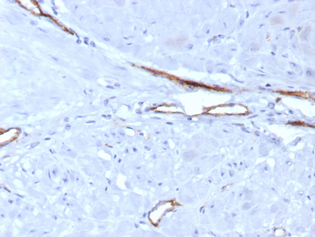 von Willebrand Factor/Factor VIII Related-Ag (Endothelial Marker) Antibody in Immunohistochemistry (Paraffin) (IHC (P))