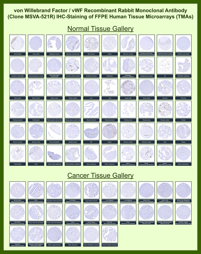 von Willebrand Factor/Factor VIII Related-Ag (Endothelial Marker) Antibody in Immunohistochemistry (Paraffin) (IHC (P))