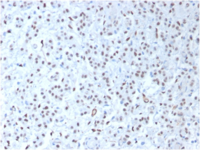 Wilms Tumor 1 (WT1) Antibody in Immunohistochemistry (Paraffin) (IHC (P))
