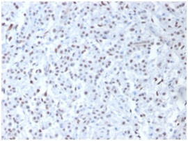 Wilm's Tumor 1 (WT1) (Wilm's Tumor and Mesothelial Marker) Antibody in Immunohistochemistry (Paraffin) (IHC (P))