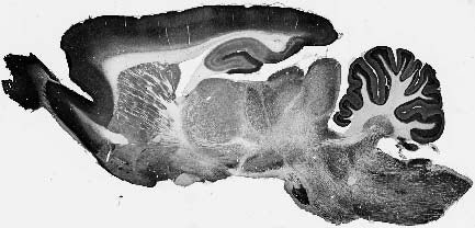 KChIP3 K+ Channel Antibody in Immunohistochemistry (Frozen) (IHC (F))