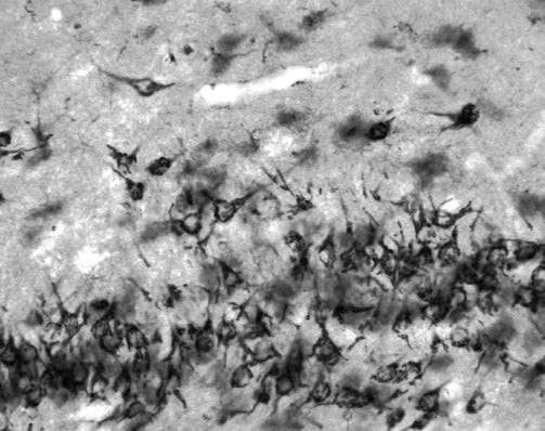 Kv1.3 K+ Channel Antibody in Immunohistochemistry (Frozen) (IHC (F))