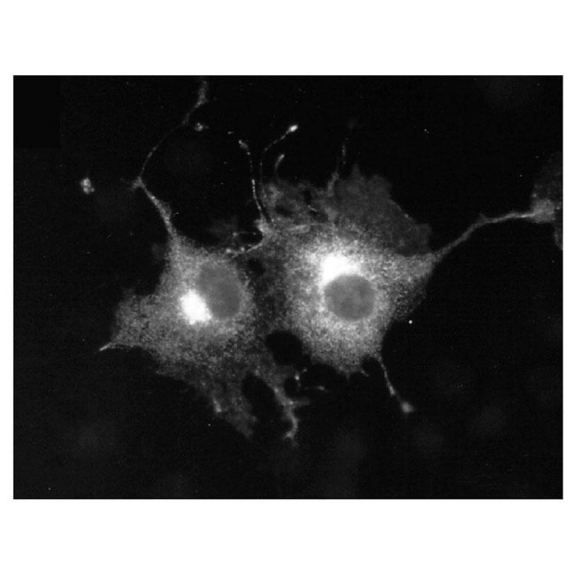 Kv1.5 K+ Channel Antibody in Immunocytochemistry (ICC/IF)