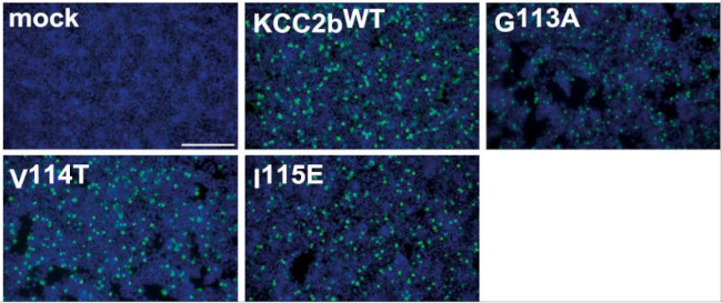 KCC2 Antibody in Immunocytochemistry (ICC/IF)