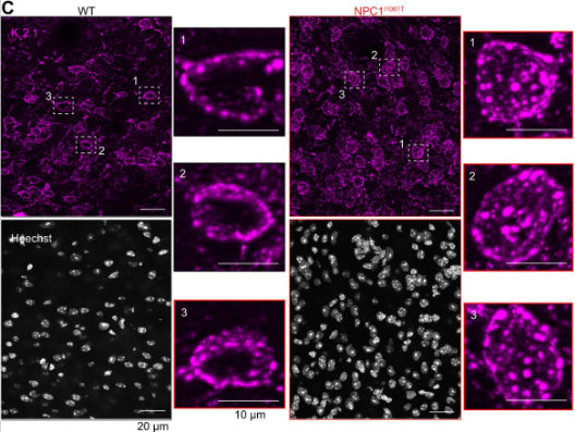 Kv2.1 K+ Channel Antibody in Immunocytochemistry (ICC/IF)
