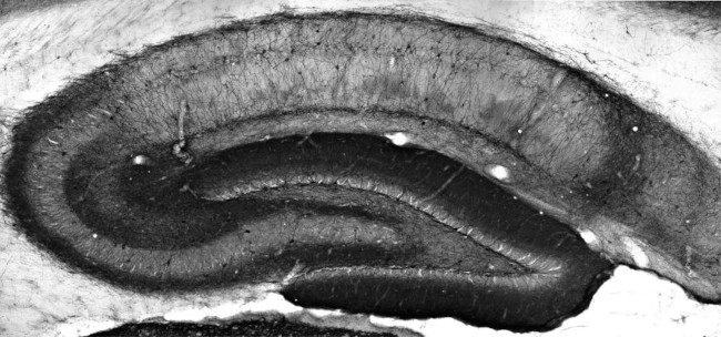 Kv4.3 K+ Channel Antibody in Immunohistochemistry (Frozen) (IHC (F))
