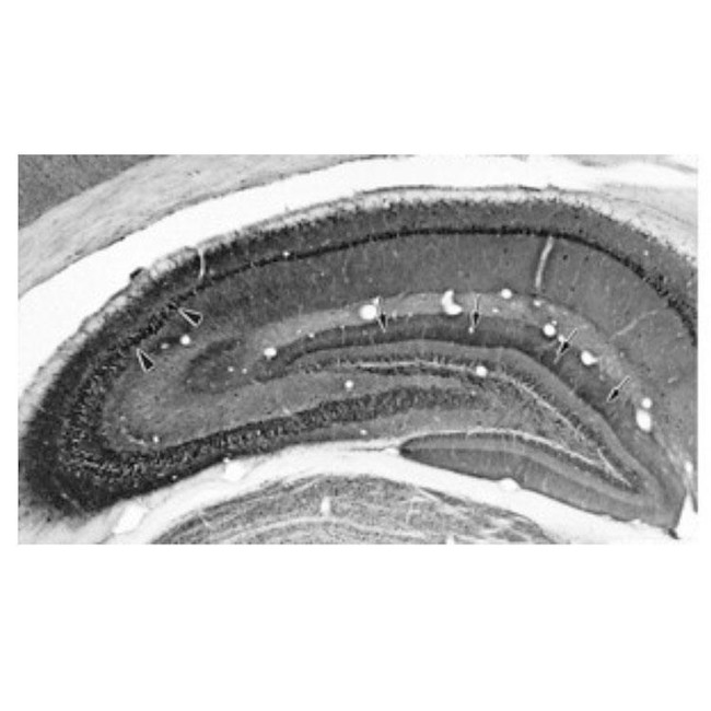 Kvbeta1.1 K+ Channel Antibody in Immunohistochemistry (Frozen) (IHC (F))