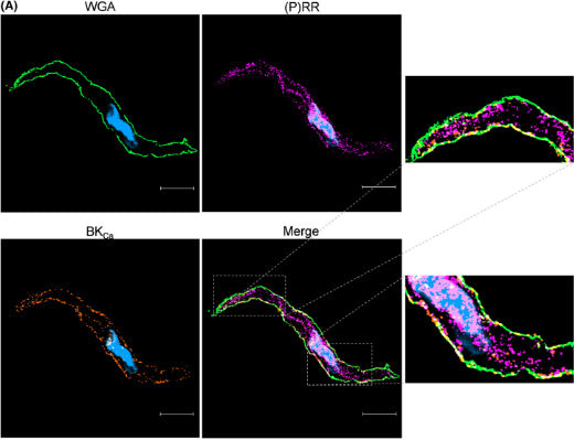 Slo1 Maxi-K+ Channel Antibody in Immunocytochemistry (ICC/IF)