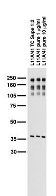Pan-Neurofascin Antibody in Western Blot (WB)