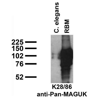 Pan-MAGUK Antibody in Western Blot (WB)