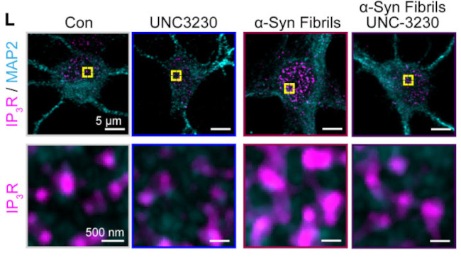 IP3 Receptor/Type 1 Antibody in Immunocytochemistry (ICC/IF)
