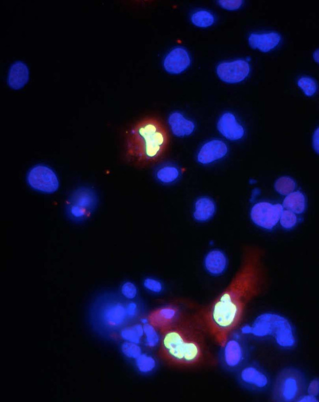 Co-Rest/RCOR1 Antibody in Immunocytochemistry (ICC/IF)
