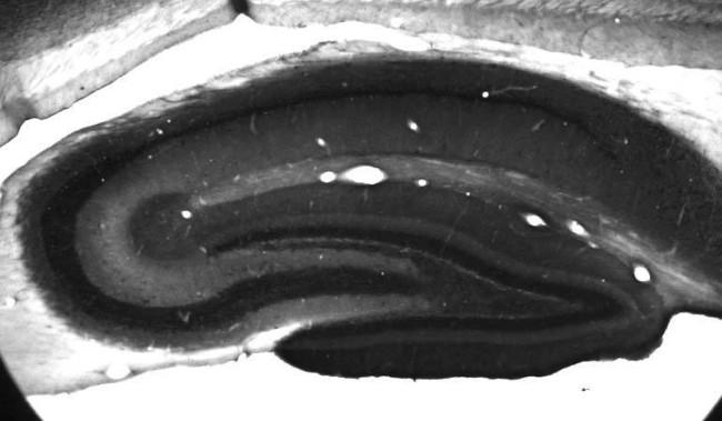 PICK1 Antibody in Immunohistochemistry (Frozen) (IHC (F))