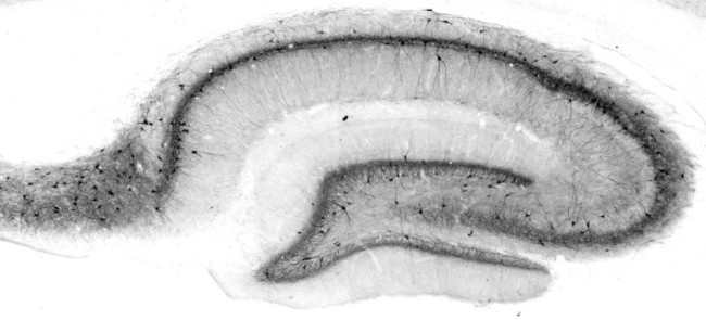 Kv3.1B K+ Channel Antibody in Immunohistochemistry (Frozen) (IHC (F))