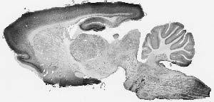 Pancortin Antibody in Immunohistochemistry (Frozen) (IHC (F))