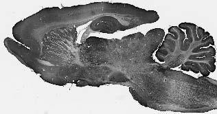 WAVE1/SCAR Antibody in Immunohistochemistry (Frozen) (IHC (F))