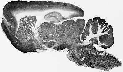 KCC2 Antibody in Immunohistochemistry (Frozen) (IHC (F))