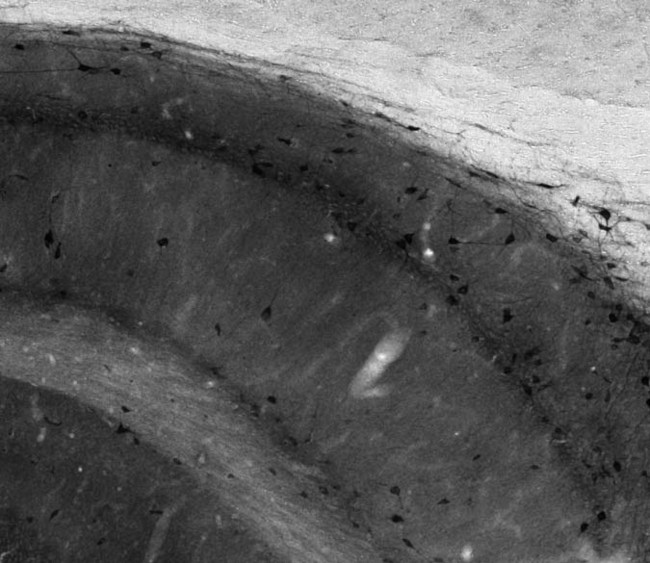 Cavbeta4 Ca2+ Channel Antibody in Immunohistochemistry (Frozen) (IHC (F))
