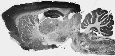 Slo2.1/Slick K+ Channel Antibody in Immunohistochemistry (Frozen) (IHC (F))