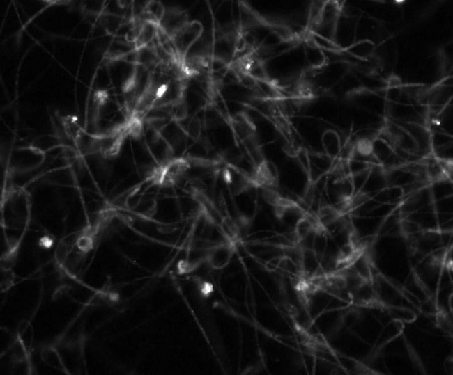 KCNU1/Slo3 pH-Sensitive Maxi-K+ Channel Antibody in Immunocytochemistry (ICC/IF)